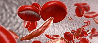 First new treatment approved by the FDA in nearly 20 years for adult patients First new treatment approved by the FDA in nearly 20 years for adult patients