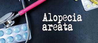 Currently, there are no FDA approved treatments for alopecia areata Currently, there are no FDA approved treatments for alopecia areata