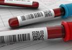 Biomarkers May Predict TKI Response in Metastatic RCC Biomarkers May Predict TKI Response in Metastatic RCC