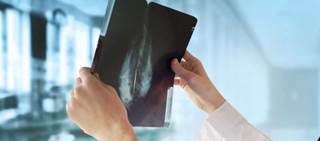 Radiomics feature model reduced false positives, with benefit seen for BI-RADS 4a, 4b lesions Radiomics feature model reduced false positives, with benefit seen for BI-RADS 4a, 4b lesions