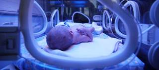 If approved, this would be the first pharmacologic treatment indicated for neonatal jaundice If approved, this would be the first pharmacologic treatment indicated for neonatal jaundice
