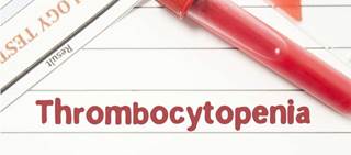 Overall response of platelet count ≥50,000/μL seen in 43% of patients. Overall response of platelet count ≥50,000/μL seen in 43% of patients.