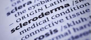 Nintedanib (Ofev), a kinase inhibitor, is currently approved to treat idiopathic pulmonary fibrosis Nintedanib (Ofev), a kinase inhibitor, is currently approved to treat idiopathic pulmonary fibrosis