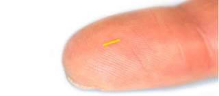 The implant is 3.5mm in length and 0.37mm in diameter; the molecules that make up the treatment can last for up to 3 years The implant is 3.5mm in length and 0.37mm in diameter; the molecules that make up the treatment can last for up to 3 years