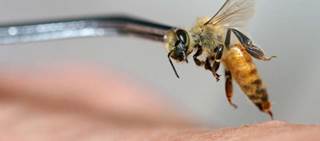 The patient suffered a watershed stroke brought on by persistent hypotension during severe anaphylaxis The patient suffered a watershed stroke brought on by persistent hypotension during severe anaphylaxis