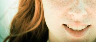 The task force deemed counseling for those aged 6 months to 24 years to prevent skin cancer a B recommendation The task force deemed counseling for those aged 6 months to 24 years to prevent skin cancer a B recommendation