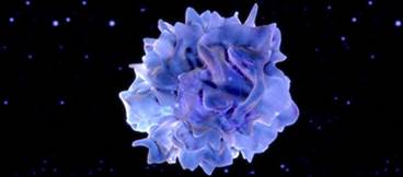 Personalized Cancer Vaccine Looks Promising in Early Study Personalized Cancer Vaccine Looks Promising in Early Study