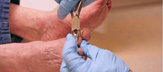 Long toenails may also indicate caregiver burnout Long toenails may also indicate caregiver burnout