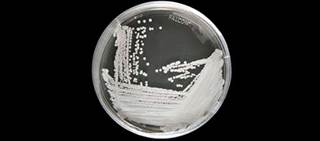 C. auris is frequently resistant to multiple antifungals C. auris is frequently resistant to multiple antifungals