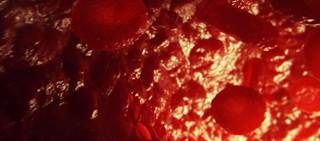 Mulpleta is a once-daily, oral, small molecule thrombopoietin receptor agonist. Mulpleta is a once-daily, oral, small molecule thrombopoietin receptor agonist.