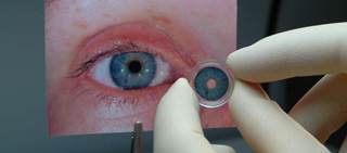 CustomFlex Artificial Iris is made of thin, foldable medical-grade silicone CustomFlex Artificial Iris is made of thin, foldable medical-grade silicone
