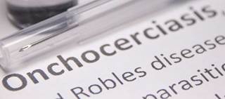 Moxidectin, a macrocyclic lactone, is an anthelmintic drug Moxidectin, a macrocyclic lactone, is an anthelmintic drug
