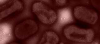 Increase seen carbapenem- and cephalosporin-resistant strains, with peak in 2008. Increase seen carbapenem- and cephalosporin-resistant strains, with peak in 2008.