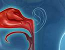 Pediatric Chronic Rhinosinusitis: Treatment Options to Consider Pediatric Chronic Rhinosinusitis: Treatment Options to Consider