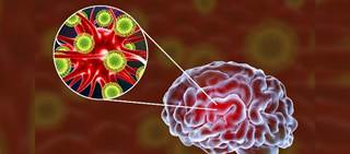 First documented case of Keystone infection in a human. First documented case of Keystone infection in a human.