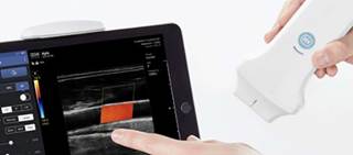 SONON 300L works in tandem with an app that displays the images for analysis. SONON 300L works in tandem with an app that displays the images for analysis.
