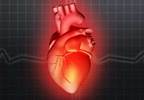 Misconceptions About Heart Disease Widespread in the United States Misconceptions About Heart Disease Widespread in the United States