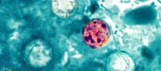 Multistate outbreak of <i>Cyclosporiasis</i> linked to McDonald's Fresh Express Salad Mix (image credit: CDC PHIL) Multistate outbreak of <i>Cyclosporiasis</i> linked to McDonald's Fresh Express Salad Mix (image credit: CDC PHIL)