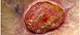 Iclaprim Gets Priority Review for Acute Bacterial Skin/Skin Structure Infections Iclaprim Gets Priority Review for Acute Bacterial Skin/Skin Structure Infections