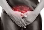 FDA Rejects Treatment for Uterine Fibroids Based on Safety Concerns FDA Rejects Treatment for Uterine Fibroids Based on Safety Concerns