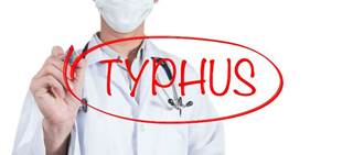 Typhus fever can cause serious complications requiring lengthy hospitalization; epidemiologists are not sure why there are more cases. Typhus fever can cause serious complications requiring lengthy hospitalization; epidemiologists are not sure why there are more cases.