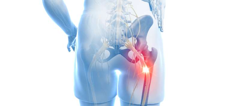 gabapentin with sciatica
