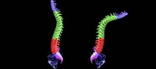 Of the 37 patients who discontinued their index TNFi, 65% switched to a different biologic Of the 37 patients who discontinued their index TNFi, 65% switched to a different biologic