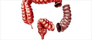 Eight-three percent of 155 patients did not need post-op narcotics; shorter length of stay with no narcotics. Eight-three percent of 155 patients did not need post-op narcotics; shorter length of stay with no narcotics.