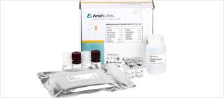 The test measures levels of Anti-Müllerian Hormone (AMH) in the blood. The test measures levels of Anti-Müllerian Hormone (AMH) in the blood.