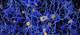 Trials Evaluating Crenezumab in Early Alzheimer Disease Halted Trials Evaluating Crenezumab in Early Alzheimer Disease Halted